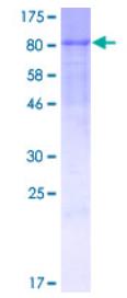 SDS-PAGE (GP1BA-5130H).jpg